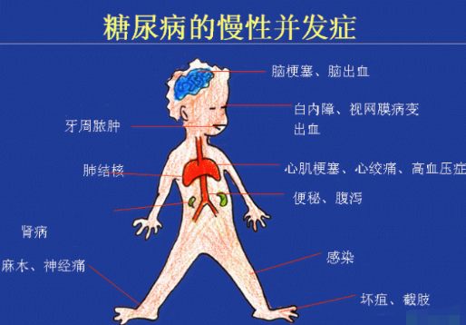 你還在害怕高血糖嗎？科學(xué)補硒不“恐糖”